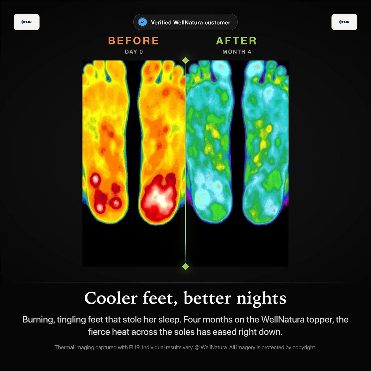 Thermal imaging of cooler feet after four months on the WellNatura topper