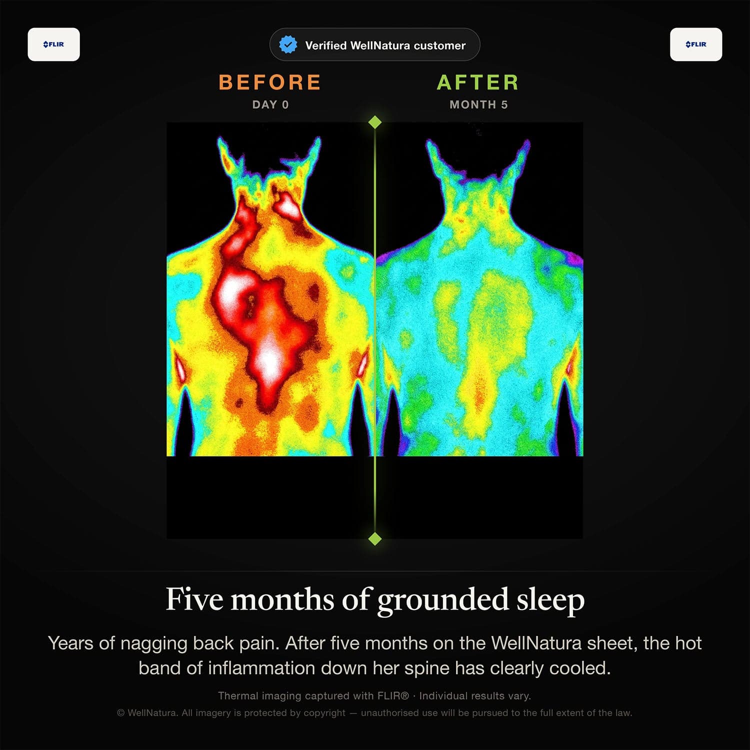 WellNatura Grounding Sheet: Proven for Deeper Sleep & Pain Relief