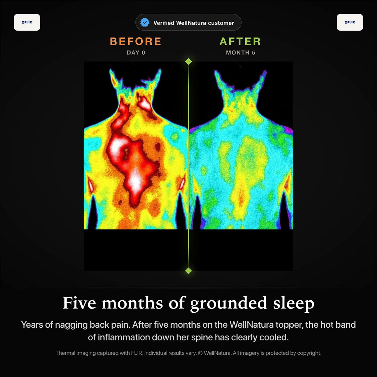 Thermal imaging before and after five months of grounded sleep on the WellNatura topper
