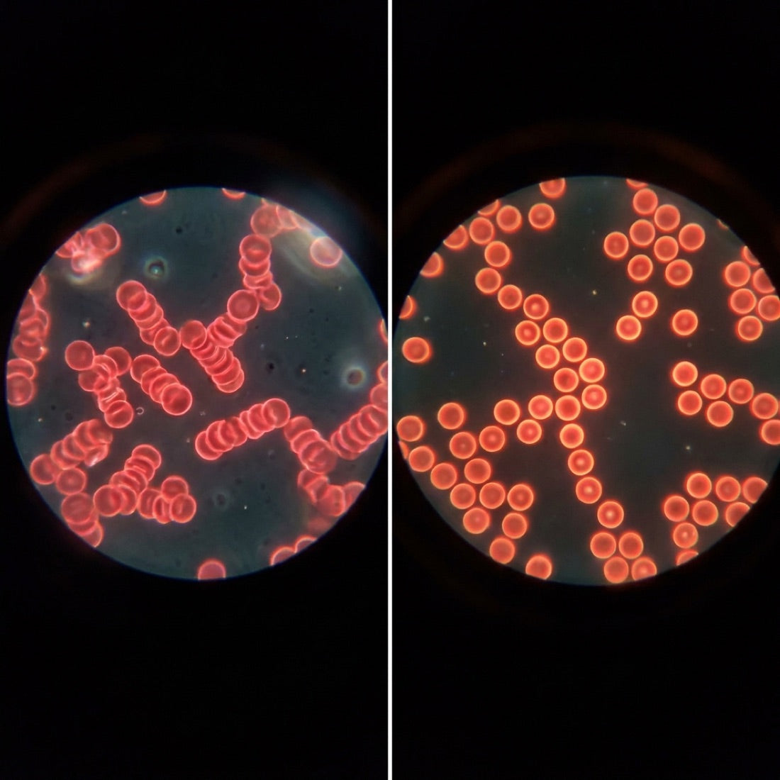 Improved blood flow in just 2 hours.